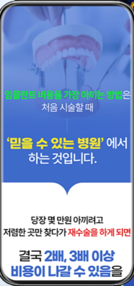 임플란트 비용을 설명하는 랜딩페이지 첫 화면