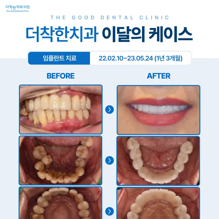 실제로 제작한 병원 디자인 13